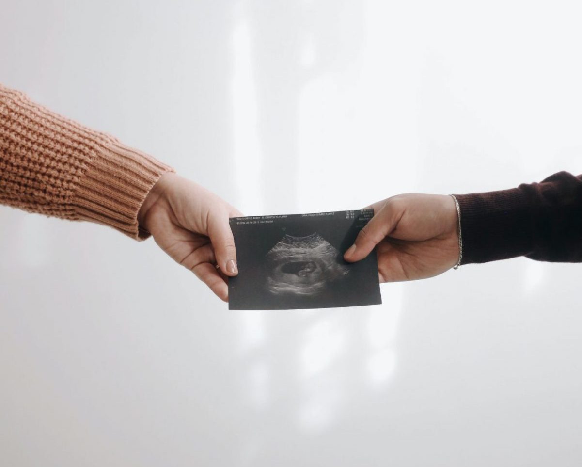 handing a picture of an ultrasound conceiving in Italy