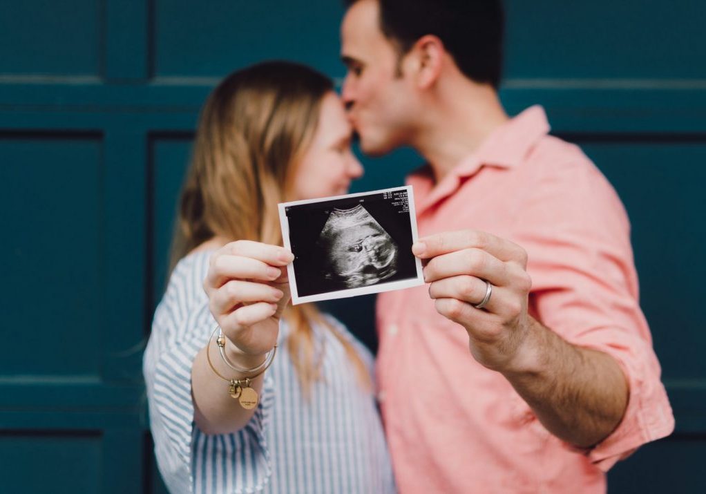 couple holding an ultrasound being pregnant in Italy